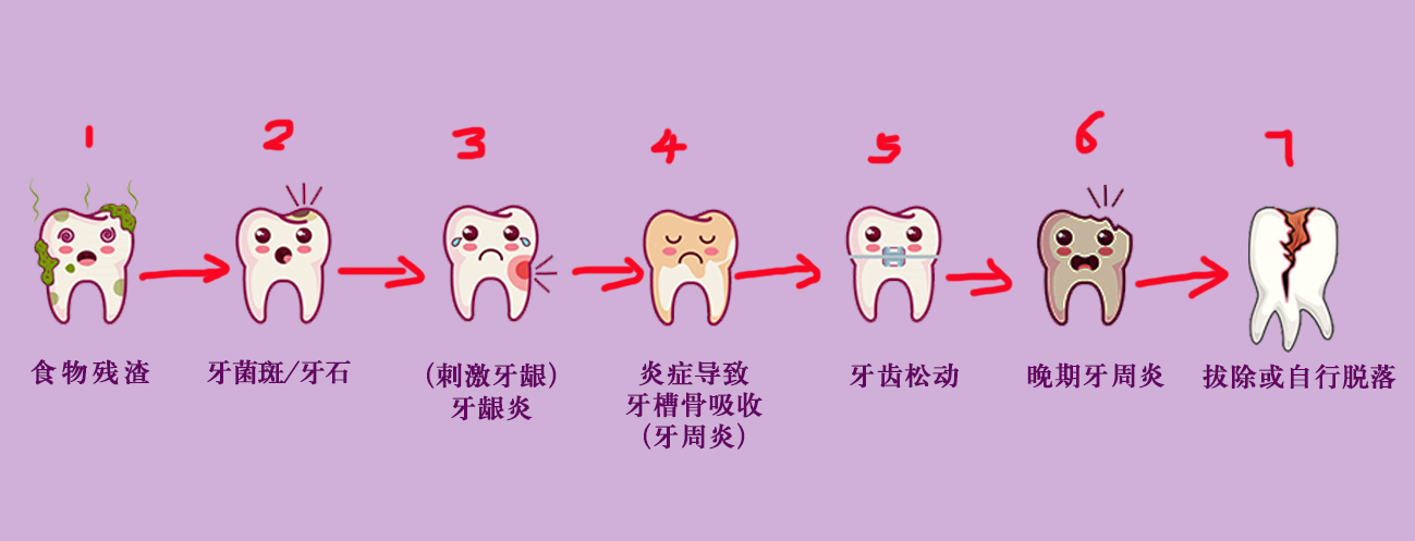 洗牙不同于牙齿美白